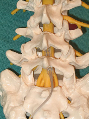 Barolats Neuroscience